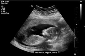 Ecografía de un bebé