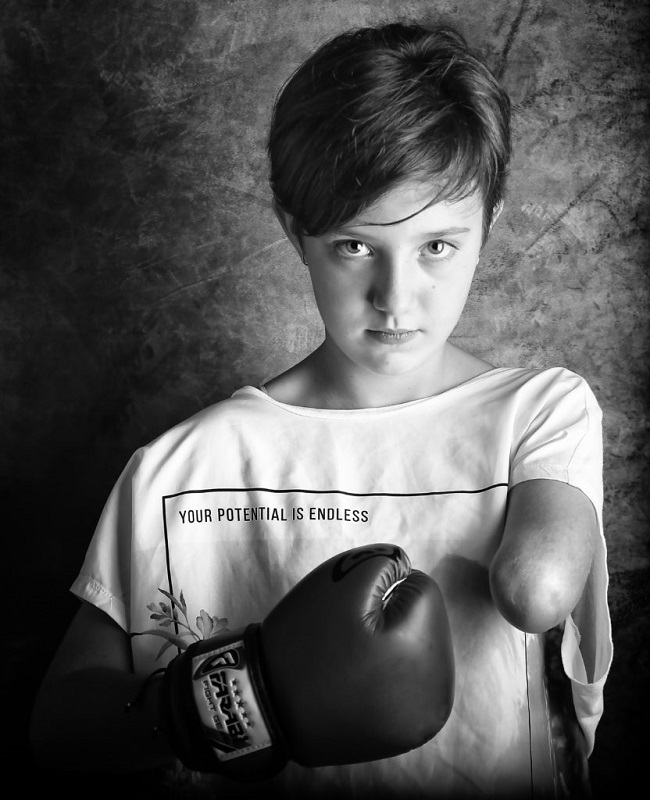 Fallados los premios del IV Concurso de Fotografía Generosidad, dedicado a denunciar la violencia contra las niñas con discapacidad