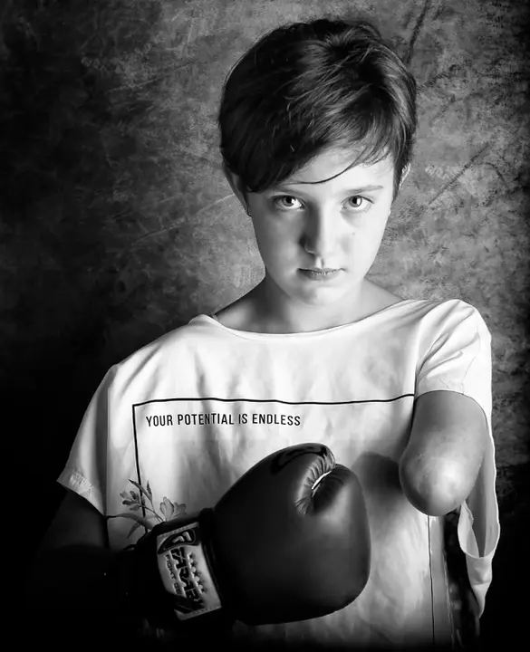 Fallados los premios del IV Concurso de Fotografía Generosidad, dedicado a denunciar la violencia contra las niñas con discapacidad