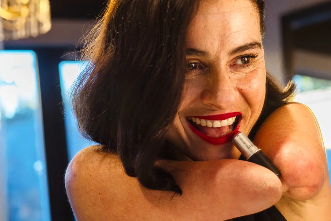 1er premio X concurso de Fotografía Generosidad 2025. “El tesón de una sirena”, de Begoña Arderius.