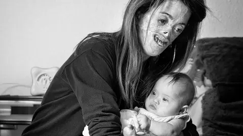 “Amor sin condición” de Vicente Guill Fuster. Foto ganadora del III Concurso de Fotografía Generosidad del 2018, FCM.